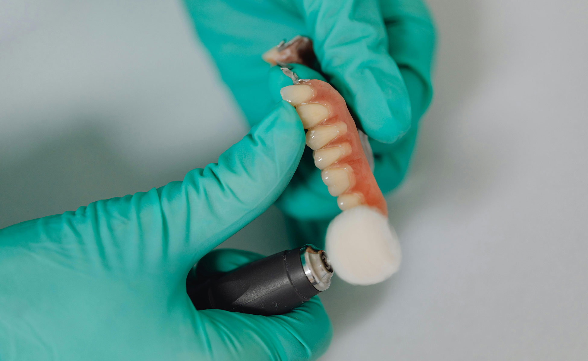 Dentist wearing gloves and holding dental implant